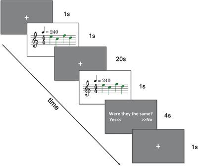 The neural coding of tonal working memory load: An functional magnetic resonance imaging study